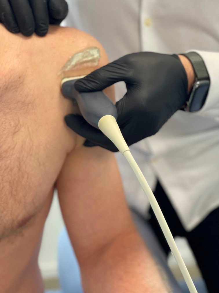 Schouderklachten verhelpen met fysiotherapie